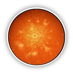 Retina